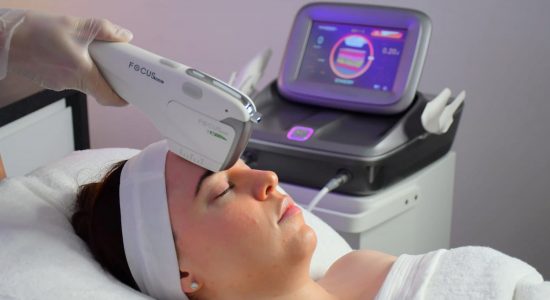 focus dual skin tightening hifu treatment on ladies forehead