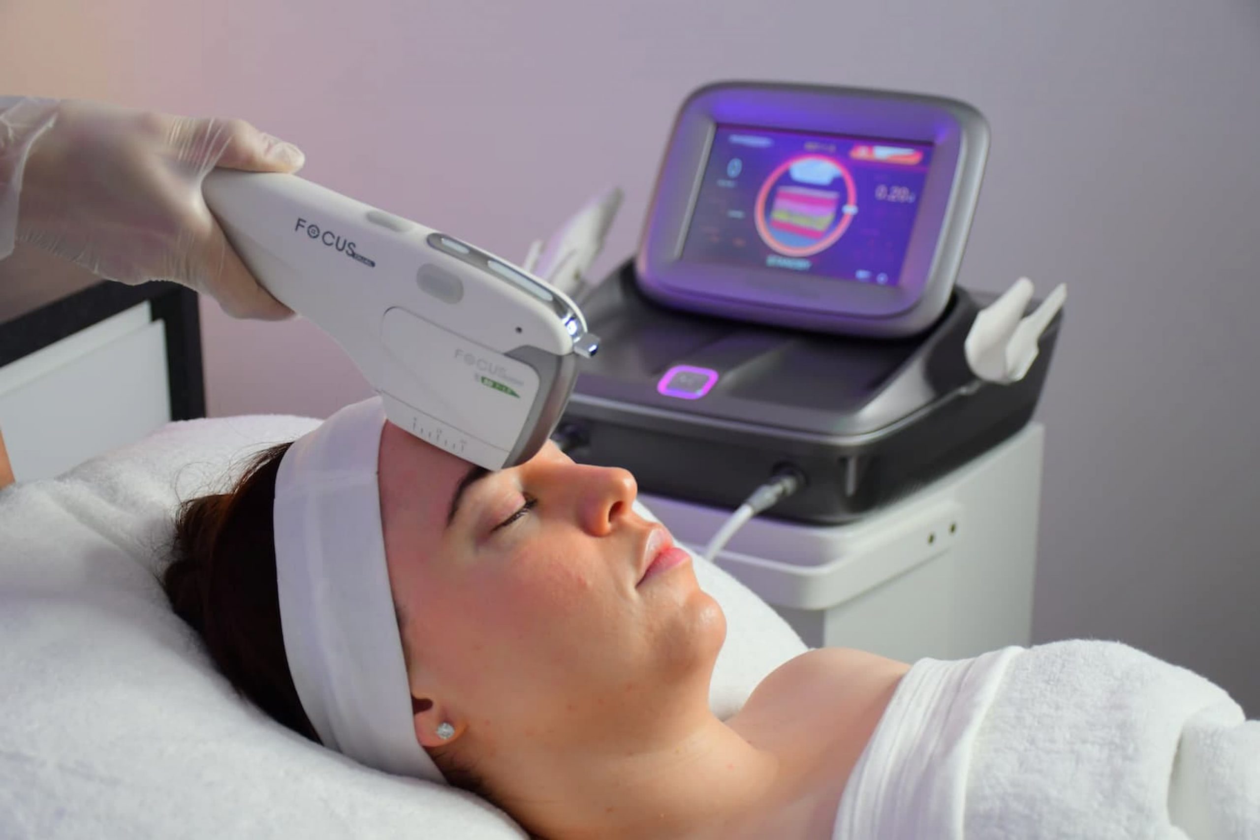 focus dual skin tightening hifu treatment on ladies forehead