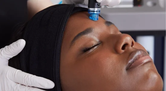 HydraFacial bristol